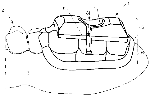 A single figure which represents the drawing illustrating the invention.